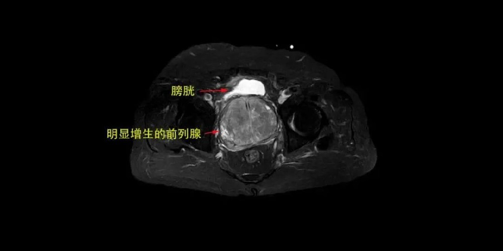 比40°高溫更難受的是……